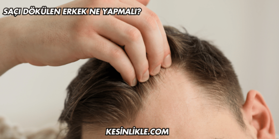 Saçı Dökülen Erkek Ne Yapmalı?